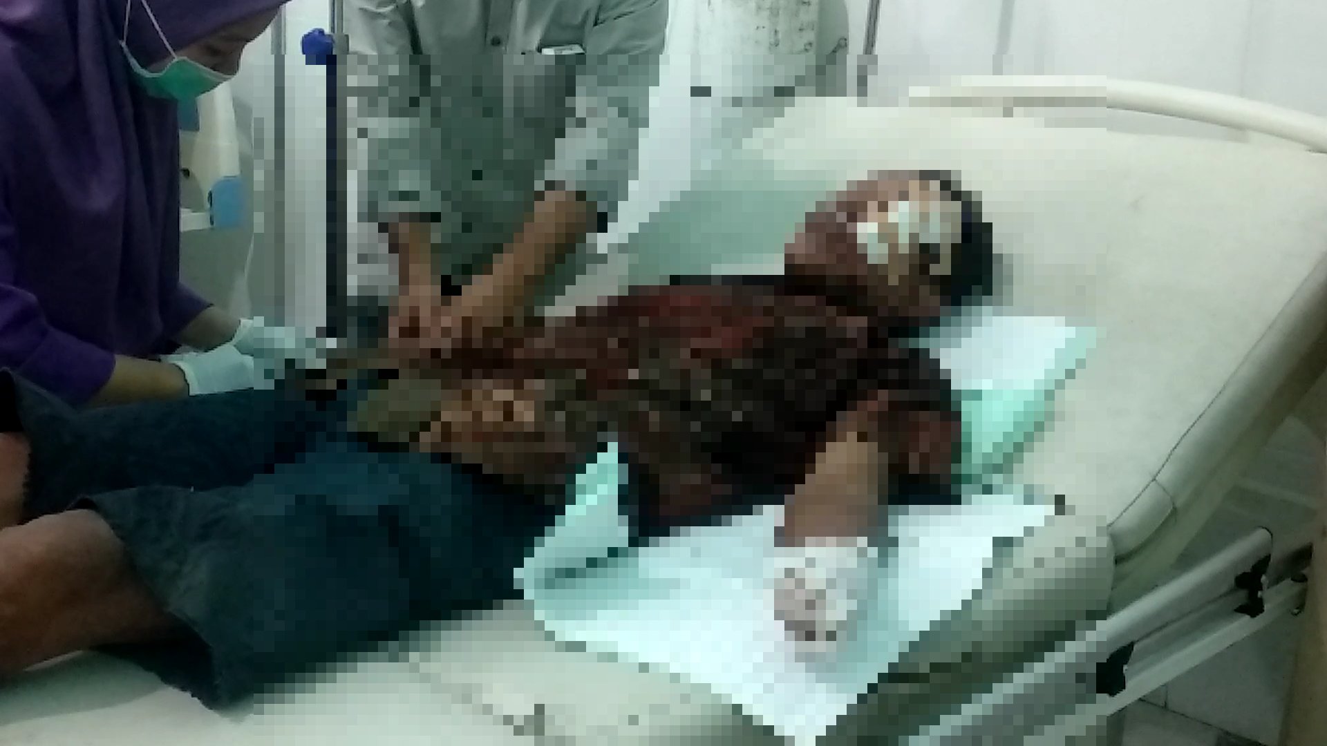 Akibat Cekcok, Pria Paruh Baya Alami Putus Pergelangan Tangan Dan Luka Sayat Pada Wajah